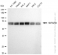 KD-Validated Anti-HNRNPM Rabbit Monoclonal Antibody