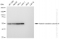 KD-Validated Anti-Katanin catalytic subunit A1 Rabbit Monoclonal Antibody