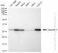 KD-Validated Anti-Galectin 3 Rabbit Monoclonal Antibody
