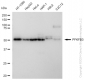 KD-Validated Anti-PFKFB3 Rabbit Monoclonal Antibody