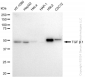 KD-Validated Anti-TGF beta 1 Rabbit Monoclonal Antibody