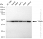 KD-Validated Anti-gamma Tubulin Rabbit Monoclonal Antibody