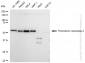 KD-Validated Anti-Thioredoxin reductase 2 Rabbit Monoclonal Antibody