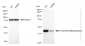 KD-Validated Anti-C-terminal binding protein 2 Rabbit Monoclonal Antibody