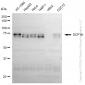 KD-Validated Anti-DCP1A Rabbit Monoclonal Antibody