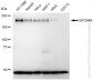 KD-Validated Anti-EIF2AK4 Rabbit Monoclonal Antibody