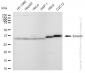 KD-Validated Anti-Emerin Rabbit Monoclonal Antibody