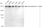 KD-Validated Anti-Aminopeptidase A / CD249 Rabbit Monoclonal Antibody