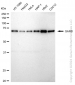 KD-Validated Anti-GARS Rabbit Monoclonal Antibody