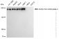 KD-Validated Anti-Acetyl-CoA carboxylase alpha Rabbit Monoclonal Antibody