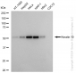 KD-Validated Anti-Keratin 10 Rabbit Monoclonal Antibody