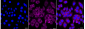 KD-Validated Anti-IGF2BP3 Rabbit Monoclonal Antibody