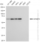 KD-Validated Anti-IGF2BP3 Rabbit Monoclonal Antibody