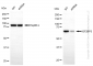 KD-Validated Anti-IGF2BP3 Rabbit Monoclonal Antibody