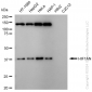KD-Validated Anti-HIF1AN Rabbit Monoclonal Antibody