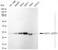 KD-Validated Anti-GST3 / GSTP1 Rabbit Monoclonal Antibody