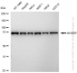 KD-Validated Anti-KHSRP Rabbit Monoclonal Antibody