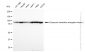 KD-Validated Anti-Eukaryotic translation elongation factor 2 Rabbit Monoclonal Antibody
