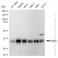 KD-Validated Anti-Musashi RNA Binding Protein 2 Rabbit Monoclonal Antibody