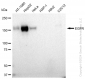 KD-Validated Anti-EGFR Rabbit Monoclonal Antibody