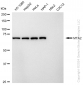 KD-Validated Anti-Metastasis Associated 1 Family Member 2 Rabbit Monoclonal Antibody