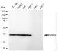KD-Validated Anti-NSDHL Rabbit Monoclonal Antibody