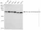 KD-Validated Anti-Pyruvate Dehydrogenase E2 Rabbit Monoclonal Antibody
