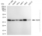KD-Validated Anti-NIMA Related Kinase 6 Rabbit Monoclonal Antibody