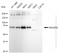 KD-Validated Anti-RAVER2 Rabbit Monoclonal Antibody