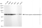 KD-Validated Anti-PRMT5 Rabbit Monoclonal Antibody