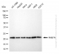 KD-Validated Anti-RAB7 Rabbit Monoclonal Antibody