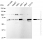 KD-Validated Anti-RelB Rabbit Monoclonal Antibody