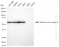KD-Validated Anti-Retinoic Acid Receptor beta Rabbit Monoclonal Antibody