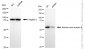 KD-Validated Anti-Retinoic Acid Receptor beta Rabbit Monoclonal Antibody
