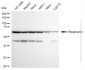 KD-Validated Anti-Ribophorin I Rabbit Monoclonal Antibody