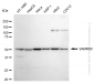 KD-Validated Anti-SAMM50 Rabbit Monoclonal Antibody