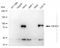 KD-Validated Anti-PIK3C3 Rabbit Monoclonal Antibody