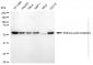KD-Validated Anti-Retinoic Acid Receptor Alpha Rabbit Monoclonal Antibody