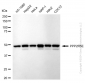 KD-Validated Anti-PPP2R5E Rabbit Monoclonal Antibody