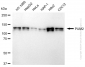 KD-Validated Anti-PUM2 Rabbit Monoclonal Antibody