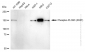 KD-Validated Anti-Phospho-PLCB3 (S537) Rabbit Monoclonal Antibody