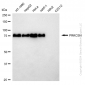 KD-Validated Anti-PRKCSH Rabbit Monoclonal Antibody