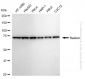 KD-Validated Anti-Radixin Rabbit Monoclonal Antibody