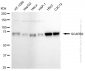 KD-Validated Anti-SCARB2 Rabbit Monoclonal Antibody