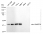 KD-Validated Anti-RABEPK Rabbit Monoclonal Antibody