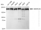 KD-Validated Anti-SMARCA4 Rabbit Monoclonal Antibody