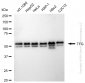 KD-Validated Anti-TRK fused gene Rabbit Monoclonal Antibody