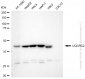 KD-Validated Anti-UQCRC2 Rabbit Monoclonal Antibody