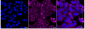 KD-Validated Anti-TRPM7 Rabbit Monoclonal Antibody