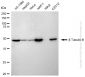 KD-Validated Anti-Tubulin Beta 3 Class III Rabbit Monoclonal Antibody